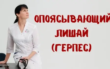 Опоясывающий лишай (герпес) 